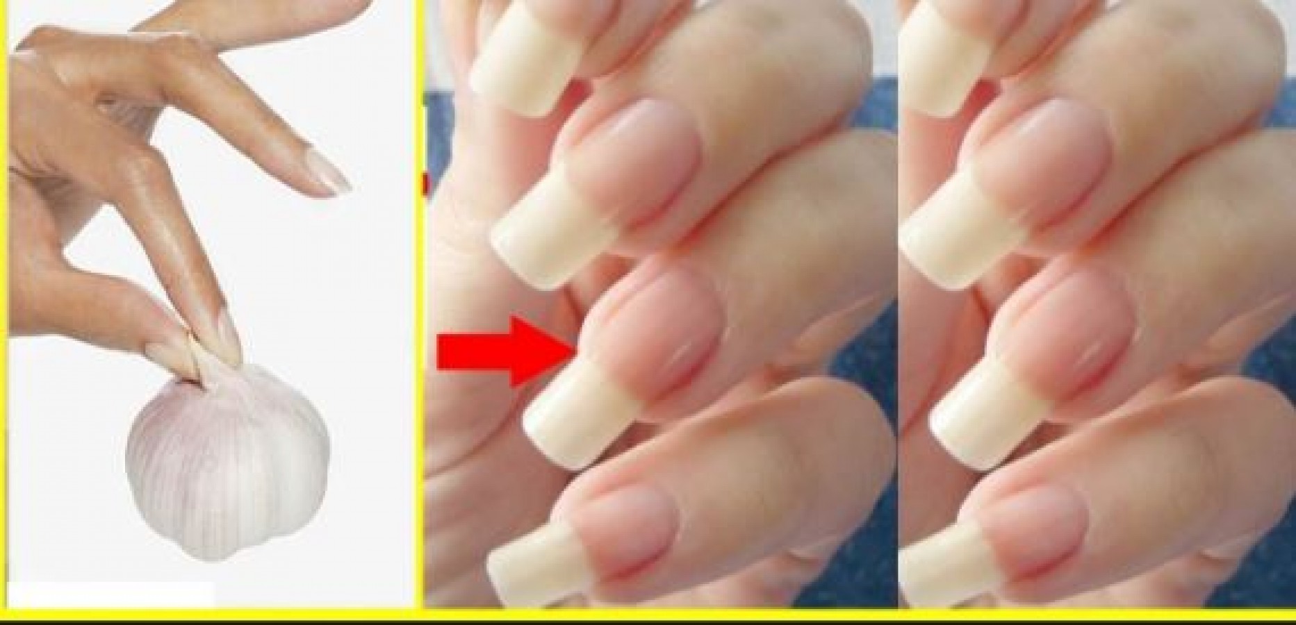 Apply this thing before going to bed at night, nails will grow faster and  look beautiful | NewsTrack English 1