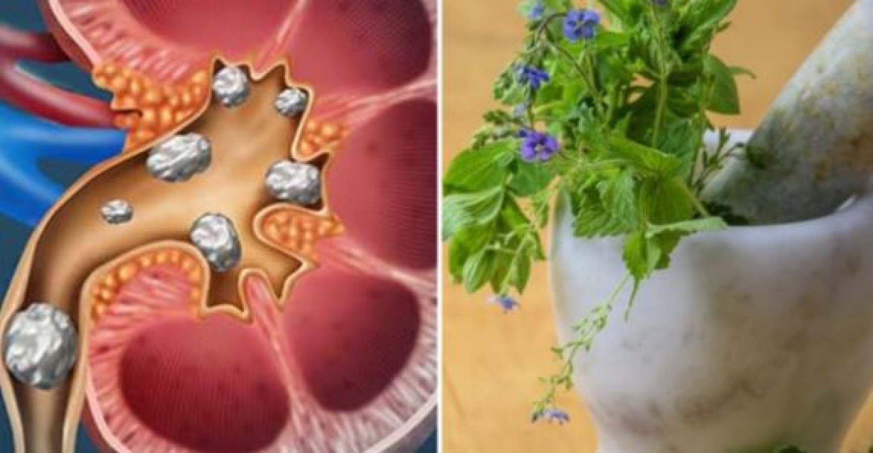 Kidney stone is easily removed by eating basil leaves to kidney