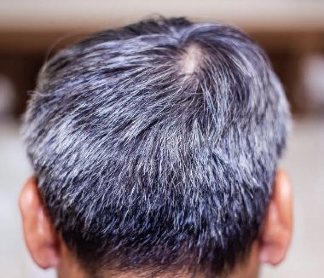 Tired of Gray Hair, 5 Best Ayurvedic remedies to get rid of it | NewsTrack  English 1