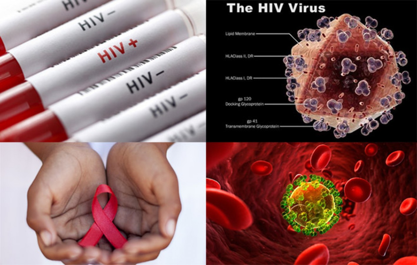 Цвет вич. ВИЧ инфекция. СПИД. Фото ВИЧ инфицированных.