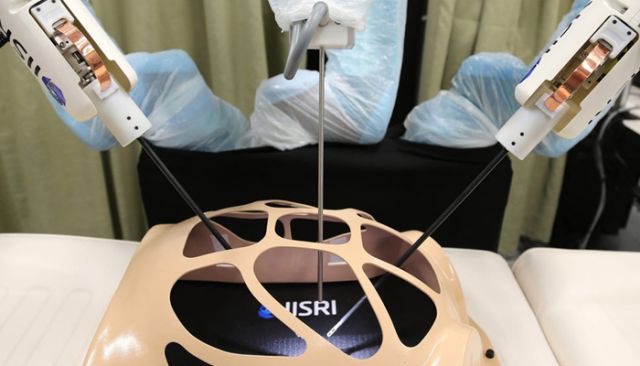 Surgeons get World's first robotic surgical system with a sense of touch!