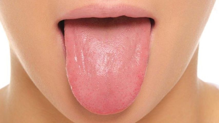 Healthy or Not - Ask your Tongue!!!
