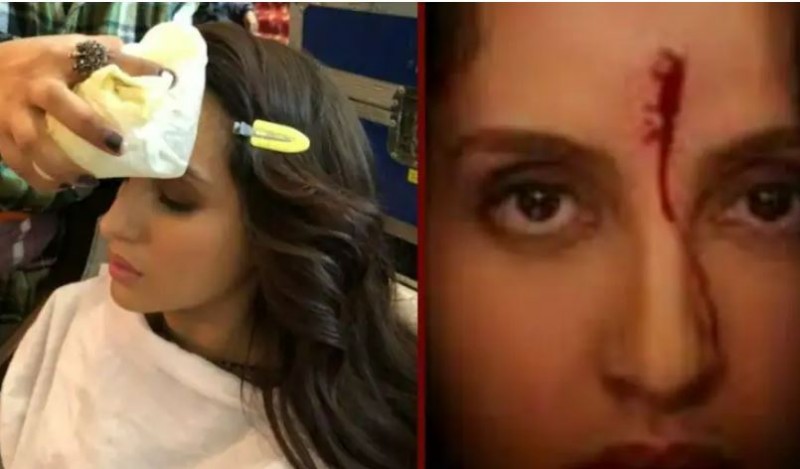 Nora Fatehi's terrible accident, auto driver collides with car