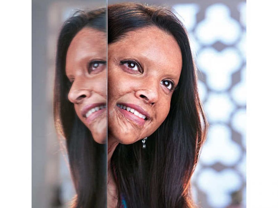 Deepika praised by fans for the role of Acid Attack Survivor in 'Chhapak'