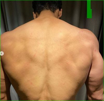 This actor shared a new picture of his back, Fans are shocked