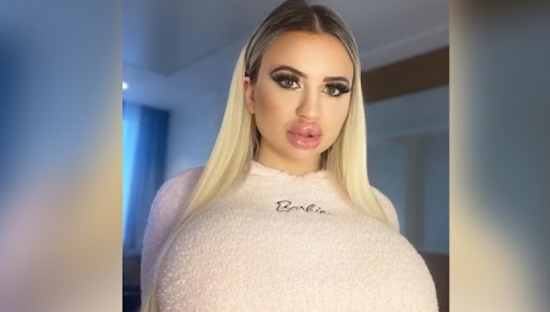 This model underwent breast surgery 4 times to look like a Barbie doll