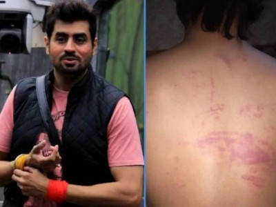 Bigg Boss' ex-contestant assaulted, know the whole matter