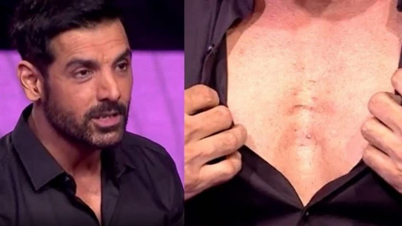 KBC 13: John Abraham reveals his chest ripped apart after a boxer kicked him