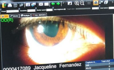 Jaqueline suffers a permanent eye injury
