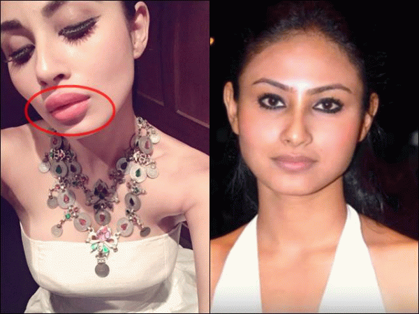 Mouni Roy's latest pictures are the proof of her lip job