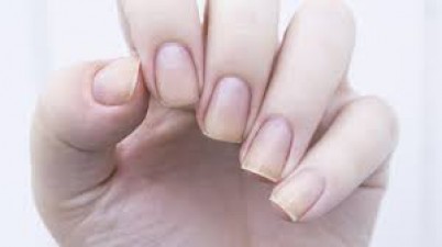 If you are fond of growing nails, know this