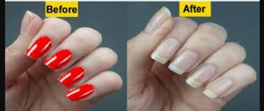 Follow these easy tips to remove nail paint easily without stains