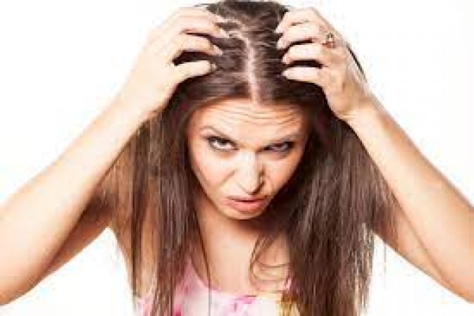 Dandruff problem increases in winter, get rid of with these home remedies