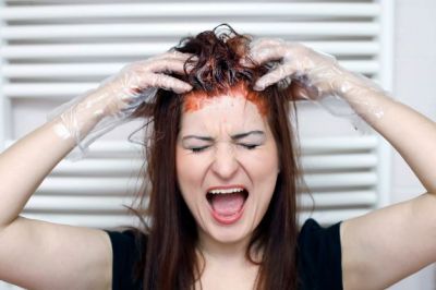 Nail polish remover helps to  get rid off hair dye from skin