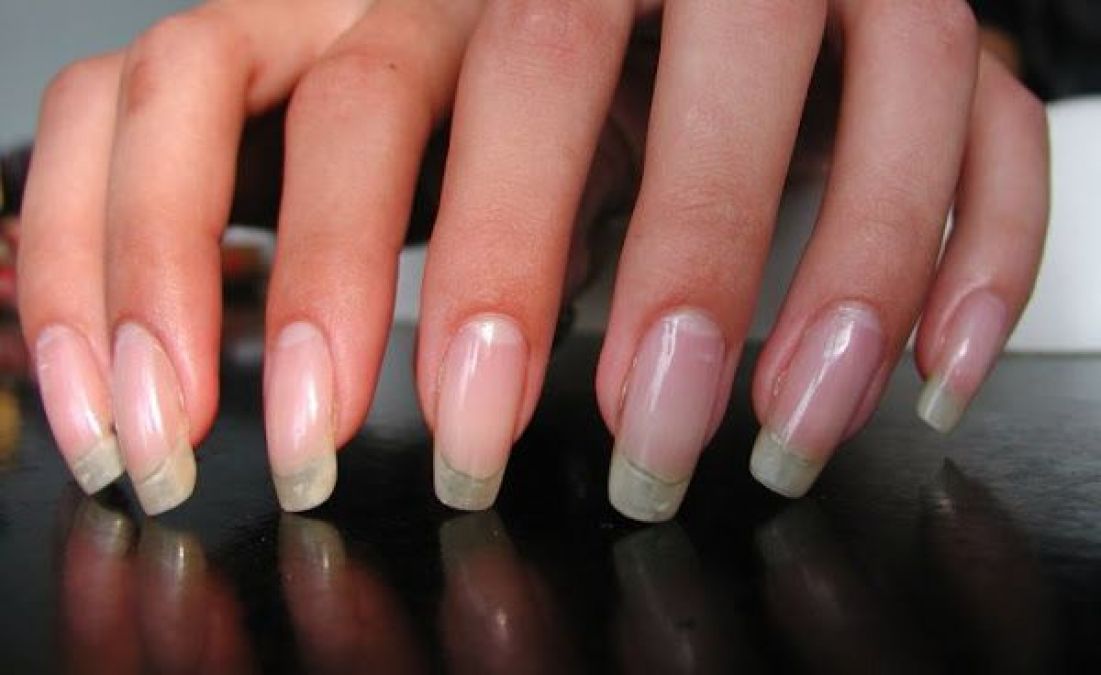 5 Incredible remedies to get shiny and healthy nails | TNAS
