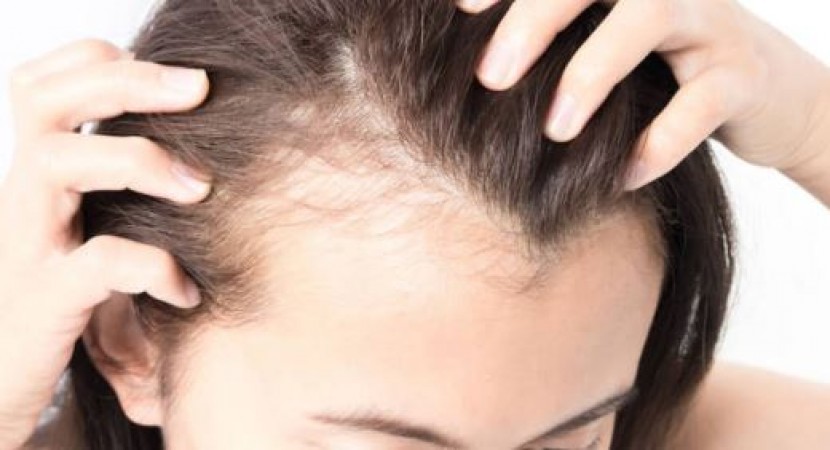 Hair has become thinner due to lack of biotin, so follow these food tips