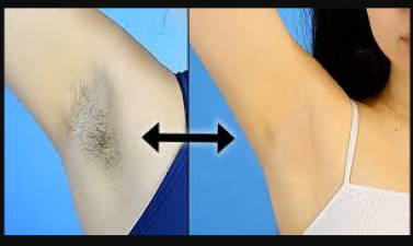 Keep these tips in mind while removing underarm's hair, will remove itchiness and rashes