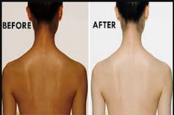 Before wearing backless blouse clean your back this way