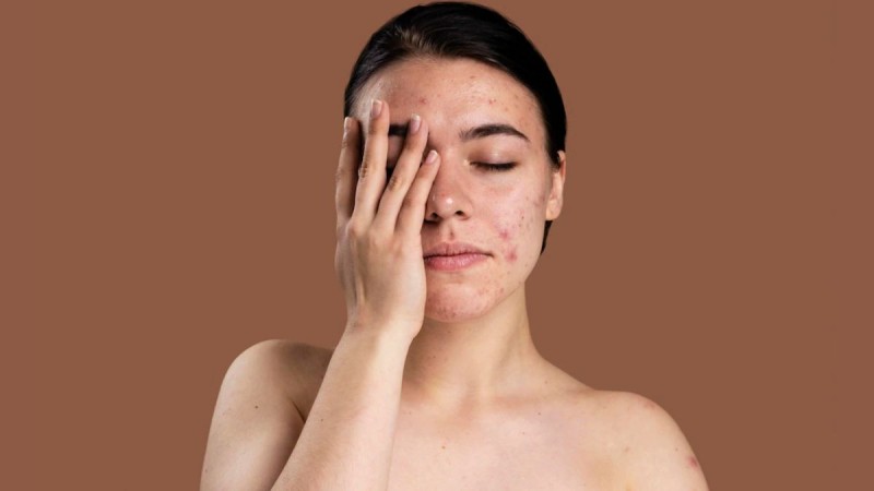 प्रदूषण से त्वचा को हो रहा है नुकसान, तो ऐसे रखें त्वचा की देखभाल