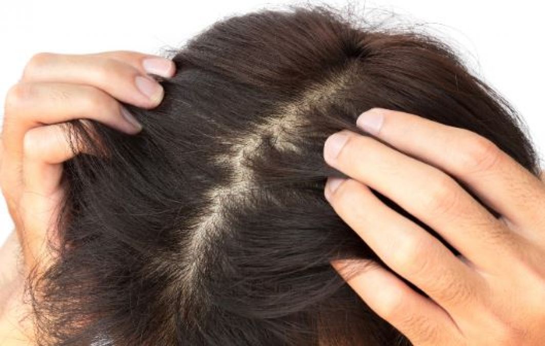 मजबूत बालों के लिए जरुरी है स्कैल्प की सफाई, जानें कैसे करें | NewsTrack  Hindi 1