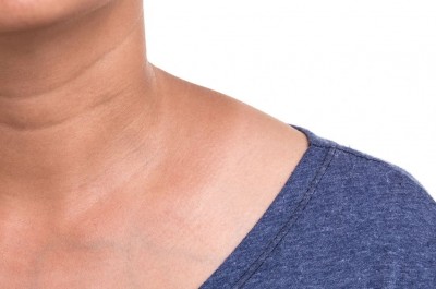 Do You Notice Black Lines on Your Neck? Be Cautious, or Else...