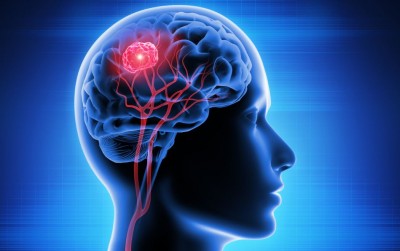 Avoiding Brain Tumors: Make Improvements Today