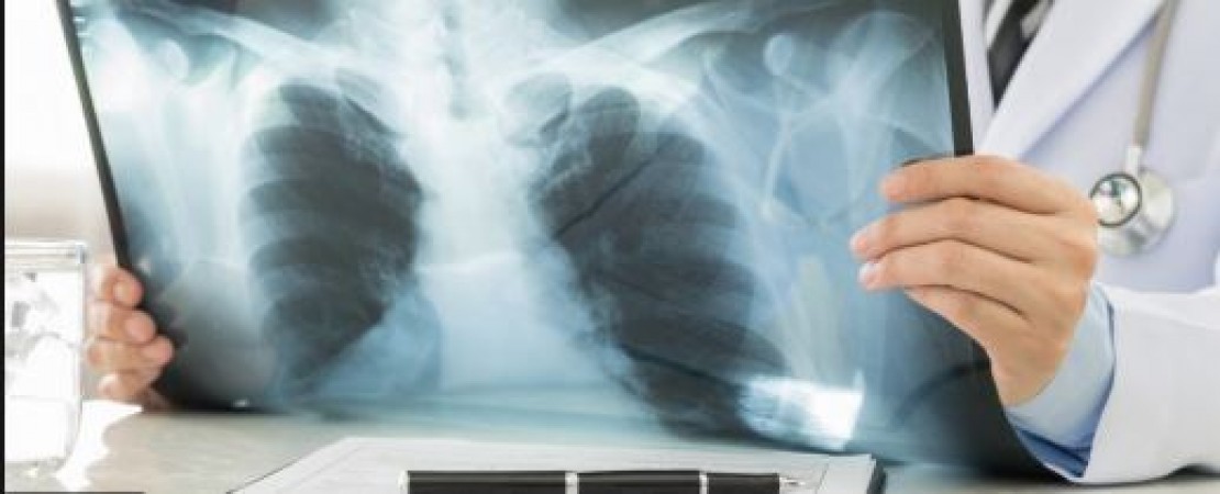 सावधान! X-ray करवाने से पहले पढ़े यह खबर वरना हो सकती है ये गंभीर बीमारी!
