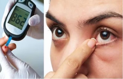 High blood sugar can cause blindness, know how to prevent