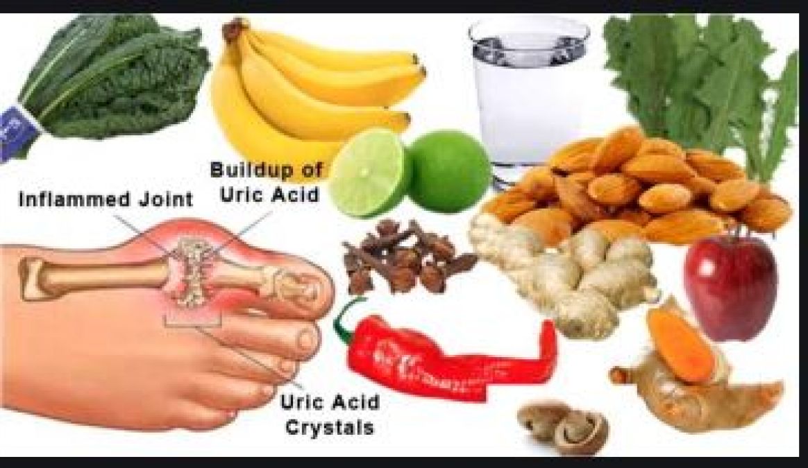 these-diseases-can-occur-due-to-an-increase-in-uric-acid-can-be