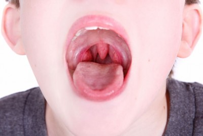 As a Result of This, Tonsils Enlarge: Learn How to Alleviate the Condition