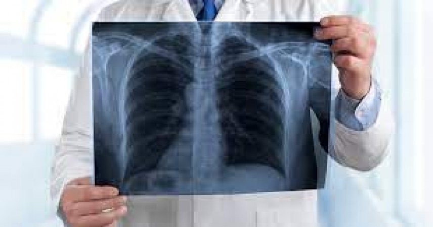 Symptoms of pneumonia, 5 effective home remedies to cure it