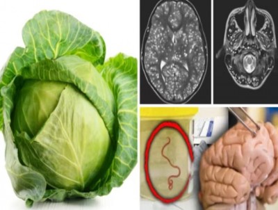 Cabbage Can Pose Risks, Experts Caution Against Potential Dangers!