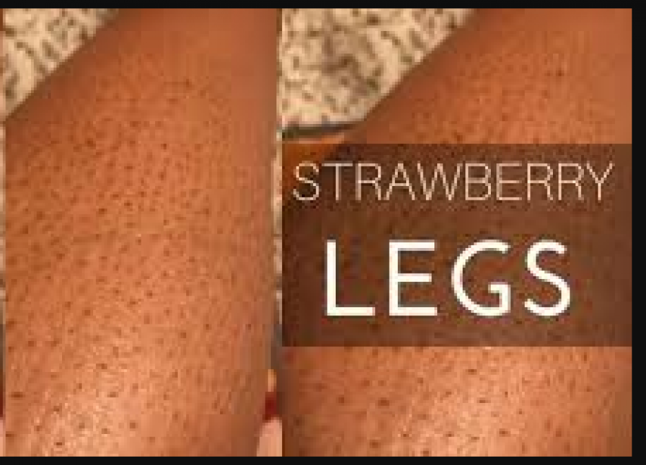 clogged pores on legs