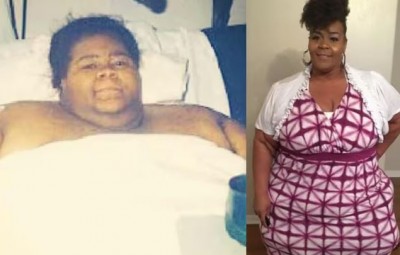 How to Lose 305 kg? The Journey of a 438-kg Woman