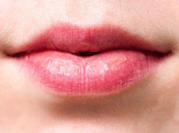 होठ और आंखों में हो रहे बदलावों को न करें अनदेखा, इन बीमारियों के होते हैं लक्षण