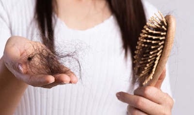 Identify Whether Your Hair Loss Is Normal or Abnormal with These Signs