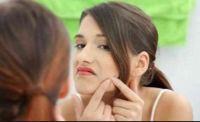 Follow these tips to cure pimples in Monsoon