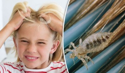 How to Rid Your Child of Lice? Effective Home Remedies