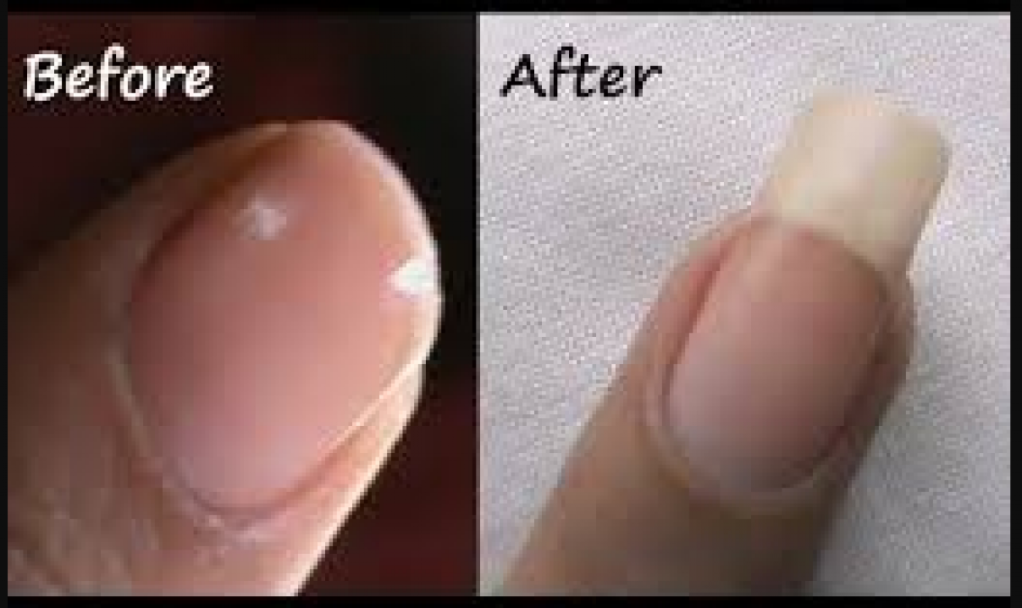 Follow these steps to get long nails soon, know here | NewsTrack English 1
