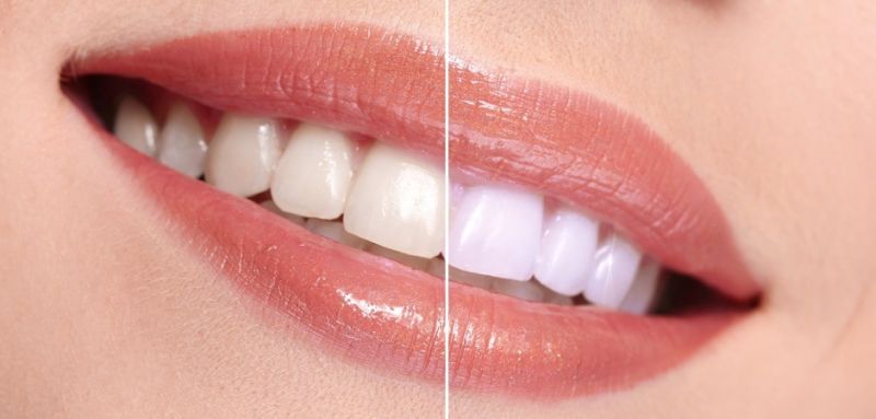 दांतों को साफ और सुंदर बनाने के लिए संतरे के छिलके का उपयोग