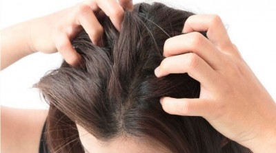 Follow these home remedies to get rid of itchy scalp