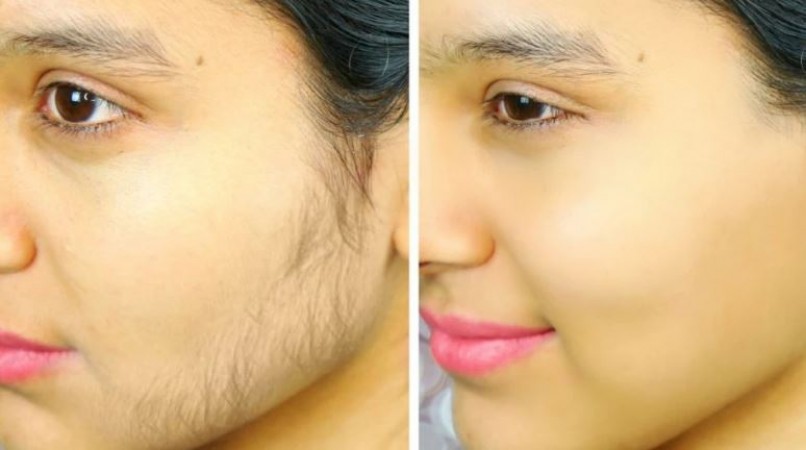 These 2 Home Remedies Are Most Effective For Removing Facial Hair |  NewsTrack English 1