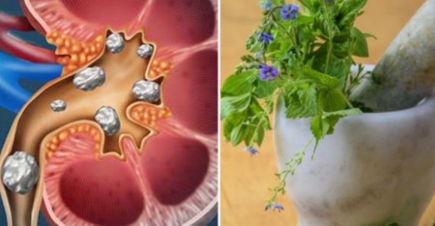 Kidney stone is easily removed by eating basil leaves to kidney beans