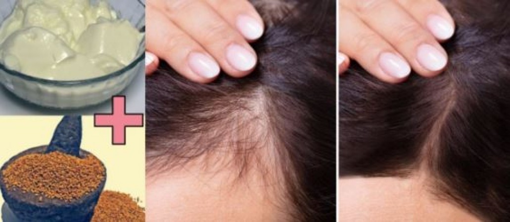 If you are a victim of baldness, then apply this thing by mixing it in curd,  hair will come faster | NewsTrack English 1