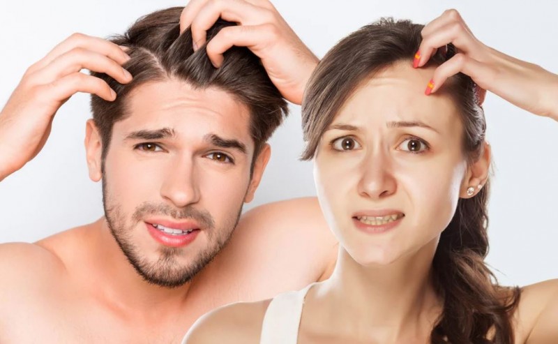 Overcome Dandruff Aggravated by Cold Weather with These Effective Tips