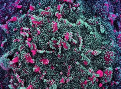 'दुनिया भर में कोरोना मचाएगा कोहराम, मरेंगे लाखों लोग', वैज्ञानिकों का दावा