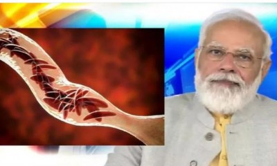 PM Modi to launch mission to eliminate sickle cell anemia