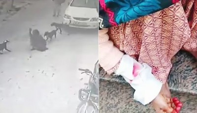 राजधानी दिल्ली में आवारा कुत्तों की दहशत, अब बुजुर्ग महिला को बनाया शिकार, अस्पताल में भर्ती