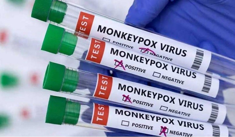 Canada reports 235 cases of monkeypox