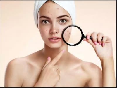 Best Home Remedies to Remove Scars, Marks and Spots to enhance the beauty